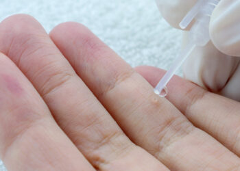 Santé : Des études montrent que le papillomavirus humain peut également provoquer un cancer chez les hommes