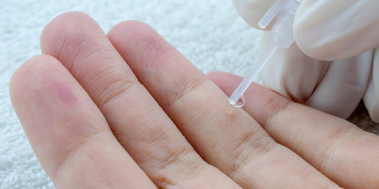 Santé : Des études montrent que le papillomavirus humain peut également provoquer un cancer chez les hommes